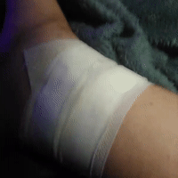 I have a bandage on