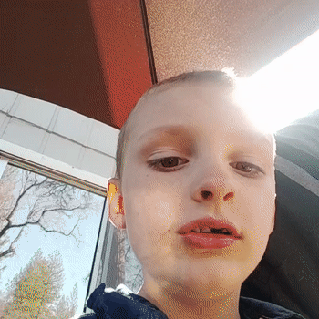 video-Scarr (15:25)
