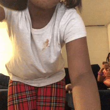 Bruises (16:46:17)