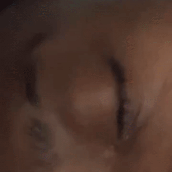 Eye Seen