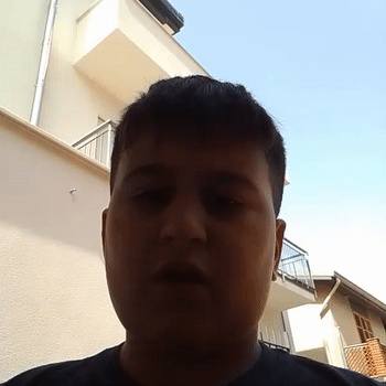 l'apparecchio dietro parolacce scusatemi sono un c*******